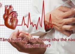 Tăng huyết áp ảnh hưởng gì đến đôi mắt? Cách phòng ngừa